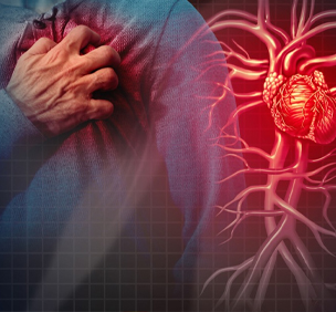 Heart Diseases