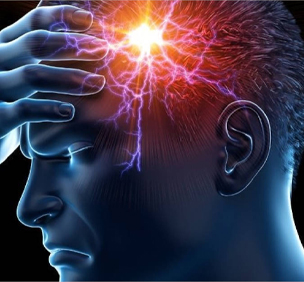 Migraine