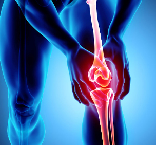 Osteoarthritis