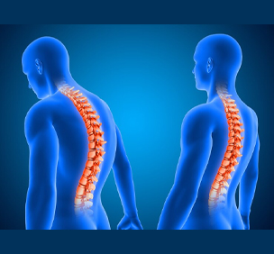 Slipped Disc