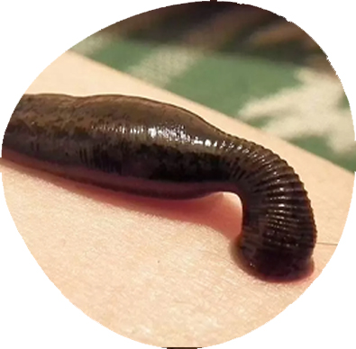Raktamokshana